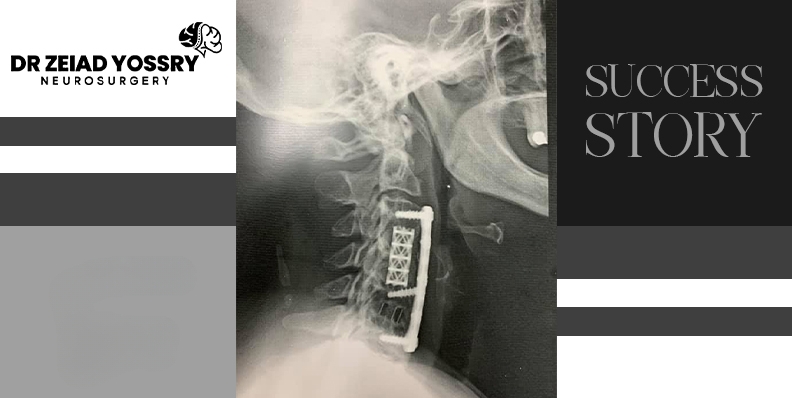 Full-Recovery-from-Quadriplegia 